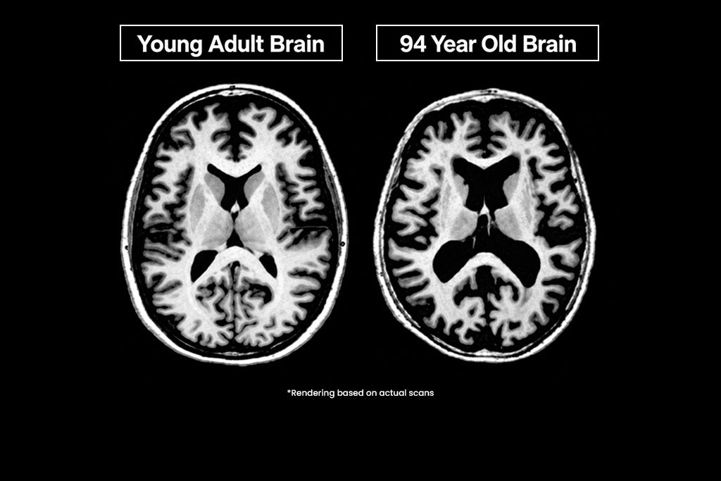 What Your Brain Needs to Stay Healthy as You Age